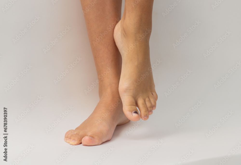 hematoma wound on runner's toe nail. consequences of wearing uncomfortable shoes or hit.feet on white or carpet,blue medicinal sheet,pills blisters,syringe.doctor hand in glove holding finger. hematoma wound on runner's toe nail. consequences of wearing uncomfortable shoes or hit.feet on white or carpet,blue medicinal sheet,pills blisters,syringe.doctor hand in glove holding finger.