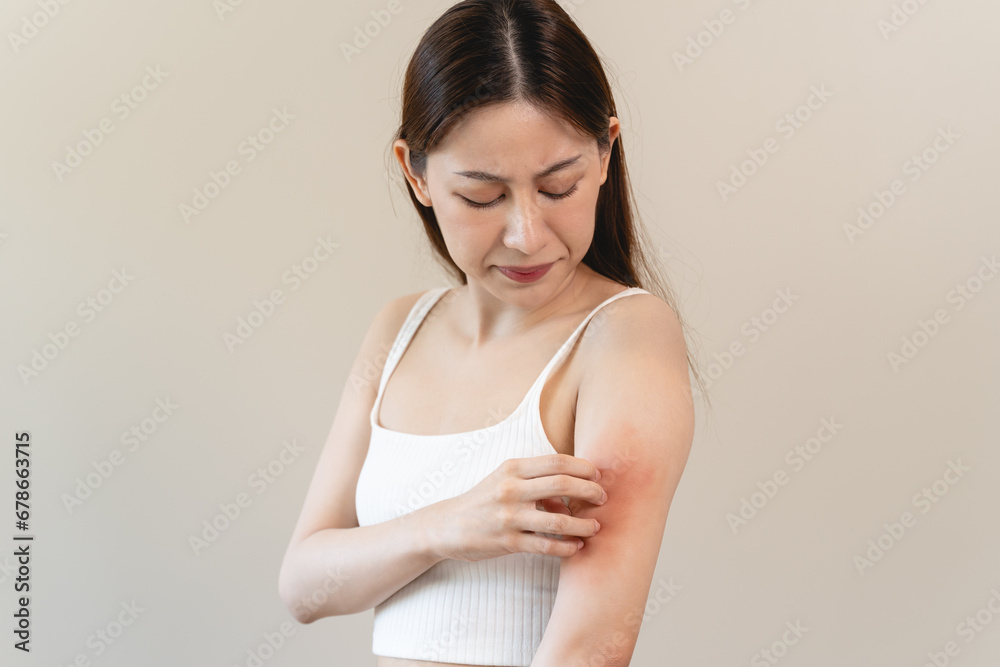 Sensitive skin allergic concept, Woman itching on her arm have a red rash from allergy symptom and from scratching. Sensitive skin allergic concept, Woman itching on her arm have a red rash from allergy symptom and from scratching.