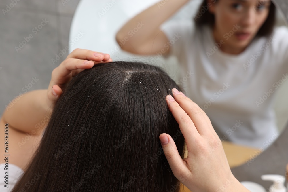 Fototapeta premium Woman examining her hair and scalp near mirror at home, selective focus. Dandruff problem