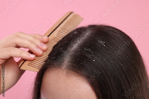 Woman with comb examining her hair and scalp on pink background, closeup. Dandruff problem