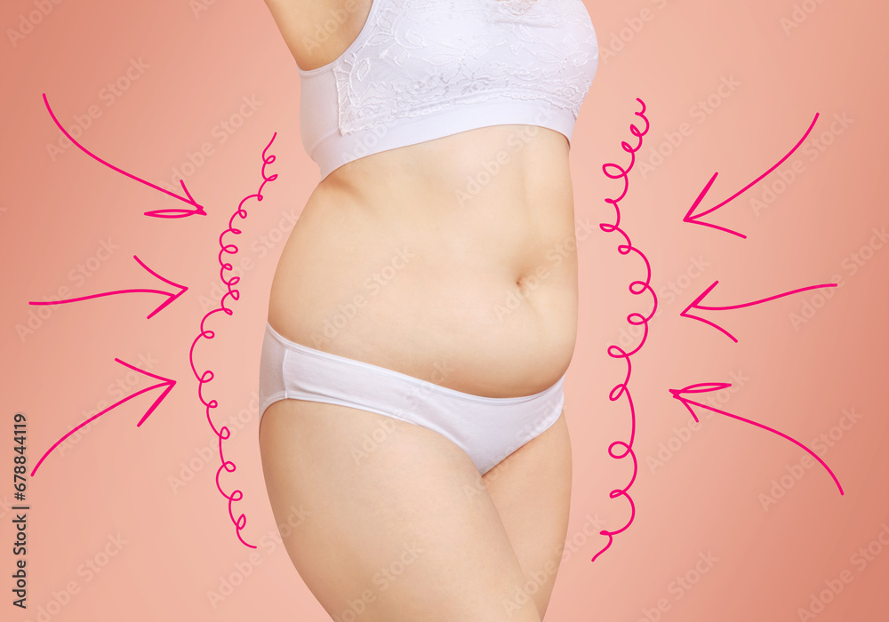 White outlines with arrows around fat body of young woman. - obrazy, fototapety, plakaty 