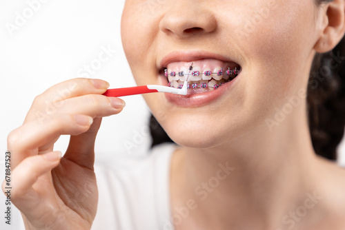 Close up of young Caucasian woman with brackets on teeth cleaning interdental space using orthodontic toothbrushes. White background. Concept of dental care during orthodontic treatment
