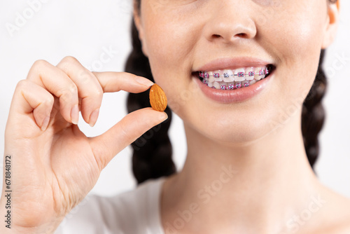 Close up of young Caucasian smiling woman with brackets show almond nut. White background. Concept of forbidden food during orthodontic treatment