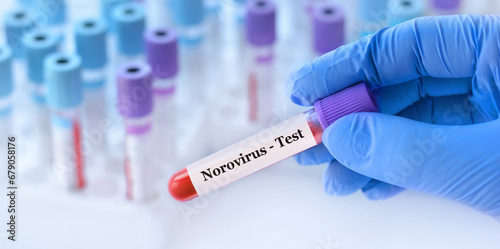 Doctor holding a test blood sample tube with Norovirus test on the background of medical test tubes with analyzes