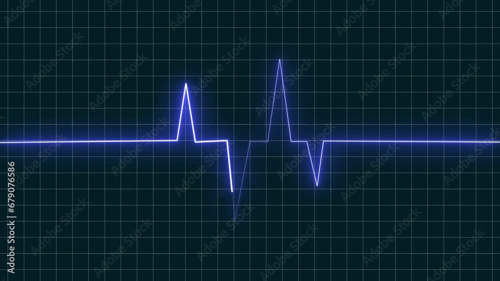 Glowing heart beat animation on black background Glowing heart beat animation on black background