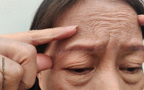 Portrait showing the fingers holding the flabbiness and wrinkle, forehead lines and flabby skin on the face of the woman, health care and beauty concept.