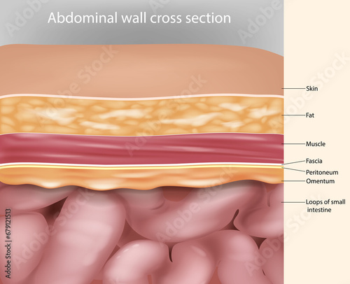 Abdominal wall cross section Anatomy. Abdominal wall layers photo