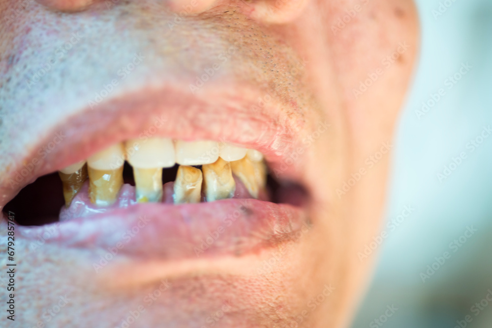 Obraz premium close up of a person with a teeth