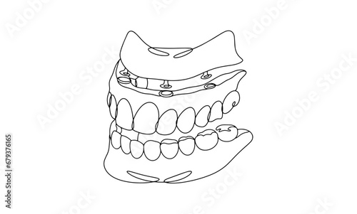 Turn. Denture. Upper jaw. One line