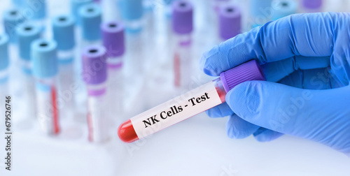 Doctor holding a test blood sample tube with NK Cell test on the background of medical test tubes with analyzes