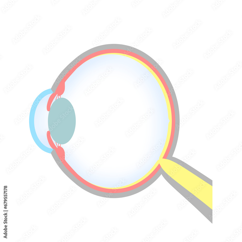 軸性遠視の眼球のイラスト 軸性遠視の眼球のイラスト
