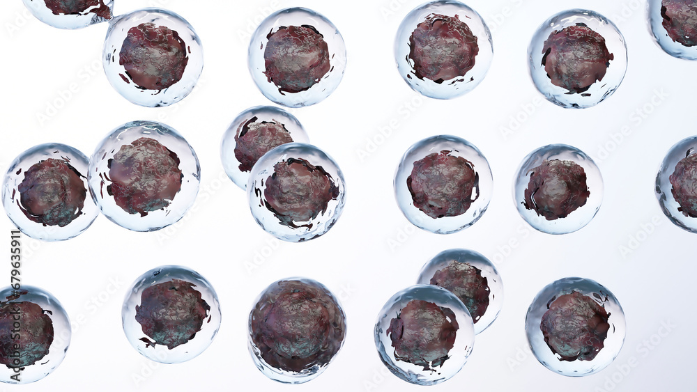 Cancer cell growth uncontrollably over tissue, Tumor infection cells ...