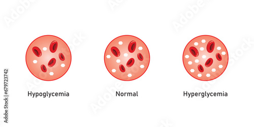 Blood glucose Level Scientific Design. Vector Illustration.