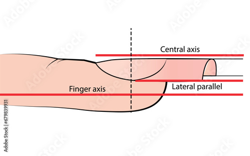 Illustration with hardware manicure technology. Correct nail shape. Educational material on vector