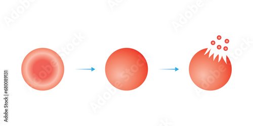 Hemolysis Process. The RBC Destruction Scientific Design. Vector Illustration.