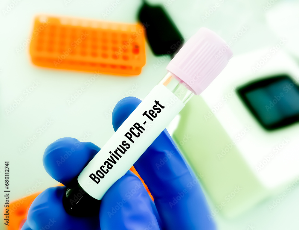 Scientist holding blood sample for Bocavirus test