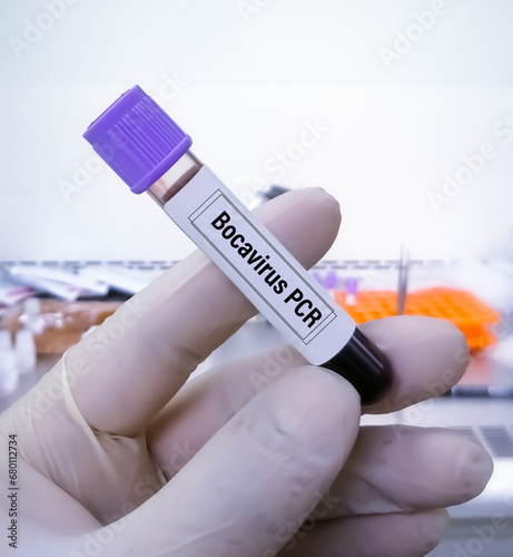 Scientist holding blood sample for Bocavirus test photo