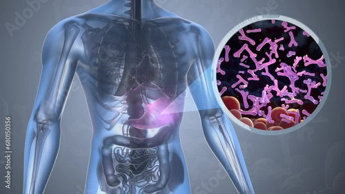 Bifidobacterium in intestine. Probiotic