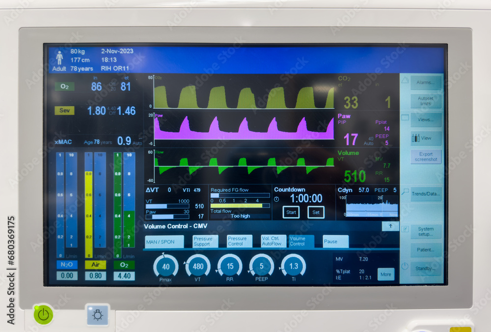 Hospital monitor displaying vital signs: heart rate, blood pressure, oxygenation, temperature, and end-tidal CO2, crucial for patient care and health assessment