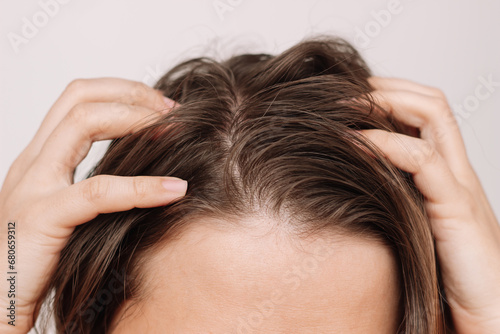 Cropped shot of a young woman with dirty greasy hair on a white background. The problem of oily scalp. Itching of the skin from long non-washes of the head
