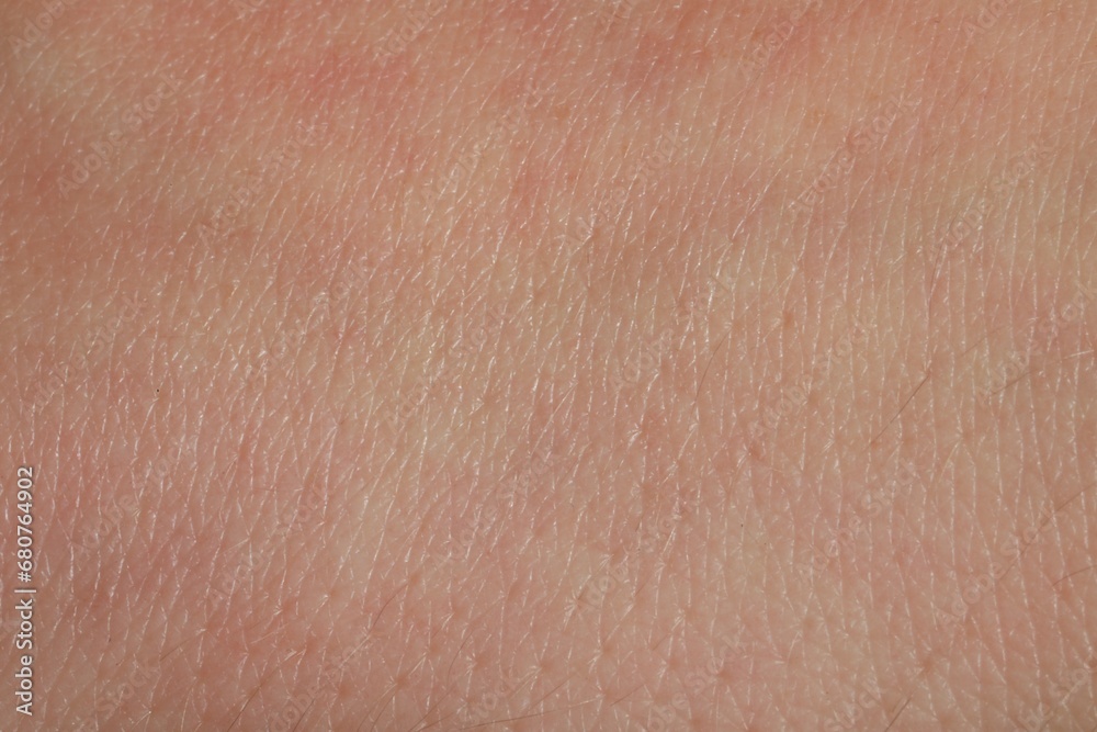Closeup view of dry human skin as background Closeup view of dry human skin as background