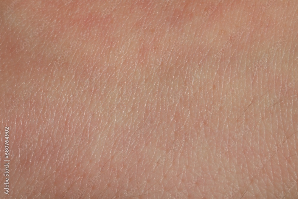 Closeup view of dry human skin as background