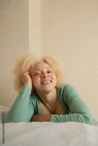 Принти на полотні Young African woman with albinism posing on bed smiling into camera