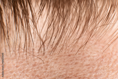 The Hair line on the man forehead - macro close up photo