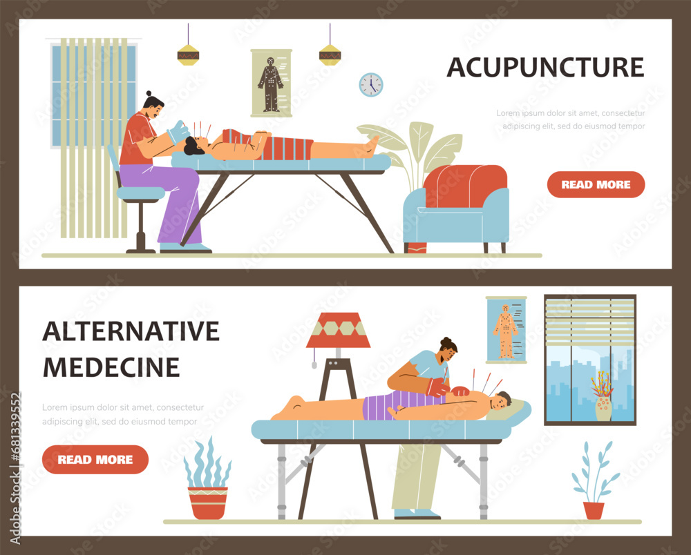 Fototapeta premium Acupuncture therapy using needles banners or flyers, flat vector illustration.