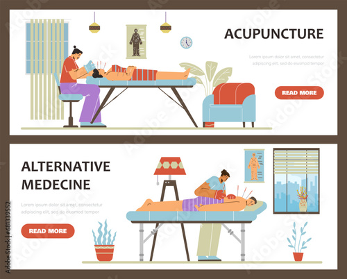 Acupuncture therapy using needles banners or flyers, flat vector illustration.