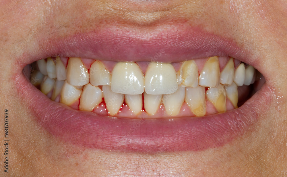 Obraz premium dental treatment pictures