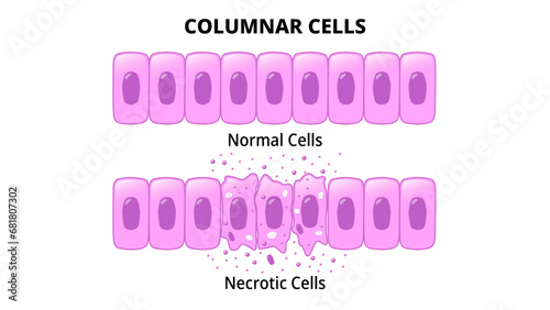Columnar Cells - Normal Epithelial Cell - Necrotic Cell - Medical Vector Illustration