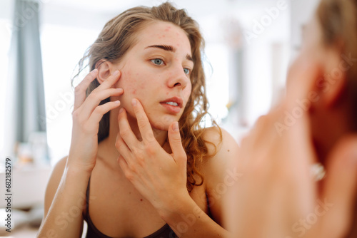 Close-up of a young woman with problem skin looking in the mirror, touching her cheek with acne. Cosmetic care. Dermatology. photo
