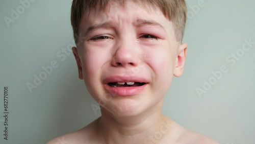 Dramatic portrait of a crying 7 year old boy. Tears flow from the eyes. The upset child. A swollen eye hurts due to a blow or insect bite. Sorrow. Children violence. Stress concept. Kids hysteria. 4K. photo