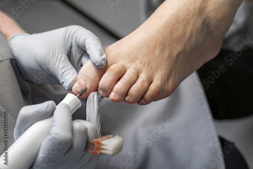 The process of filing off a thickened old nail from the fingers of an elderly woman. Procedure podologist. photo