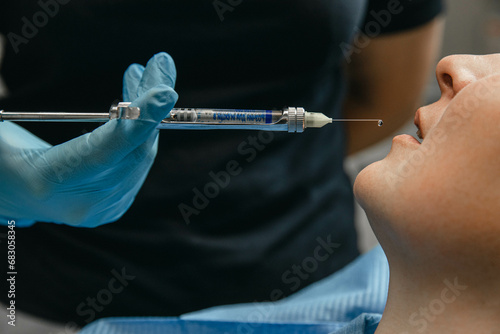 Anesthesia in dentistry. Anesthetic before dental treatment. Anesthetic in a syringe in front of the patient's mouth photo