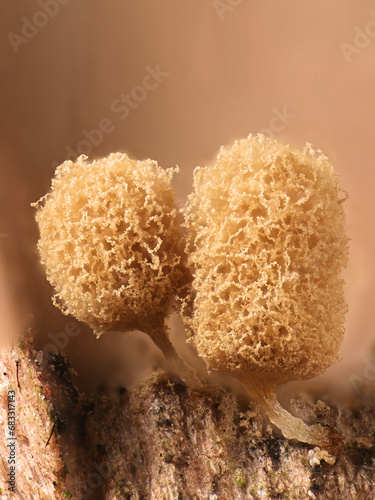 Microscope image of Arcyria pomiformis, a slime mold of the order Trichiales, no common English name
