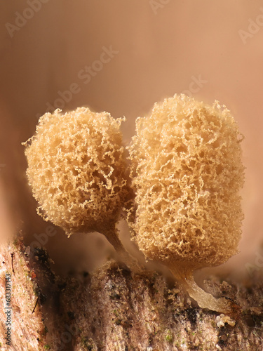 Microscope image of Arcyria pomiformis, a slime mold of the order Trichiales, no common English name photo