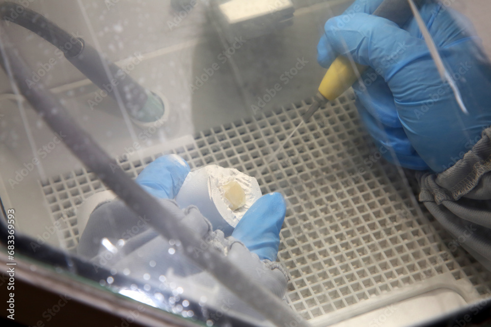 Fabrication of dental crowns and dentures made of ceramic. Scanning of plaster casts of teeth. Fabrication of ceramic dentures in a dental clinic. Ceramic dental crowns for implants. Fabrication of dental crowns and dentures made of ceramic. Scanning of plaster casts of teeth. Fabrication of ceramic dentures in a dental clinic. Ceramic dental crowns for implants.