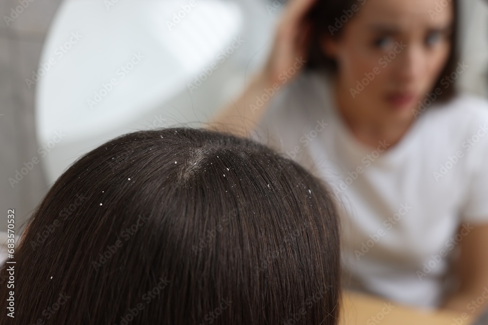 Fototapeta premium Woman examining her hair and scalp near mirror at home, selective focus. Dandruff problem