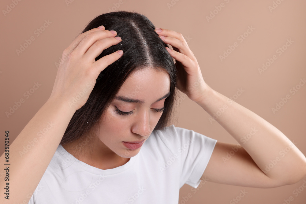 Woman suffering from dandruff problem on beige background Woman suffering from dandruff problem on beige background