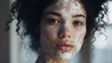 Young woman with vitiligo on her face