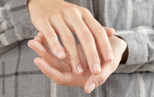 Fingernails with onycholysis after removing gel polish. Womans hands with damaged nails photo