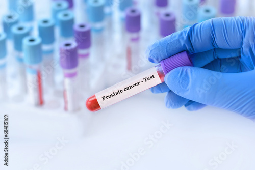 Doctor holding a test blood sample tube with prostate cancer test on the background of medical test tubes with analyzes photo