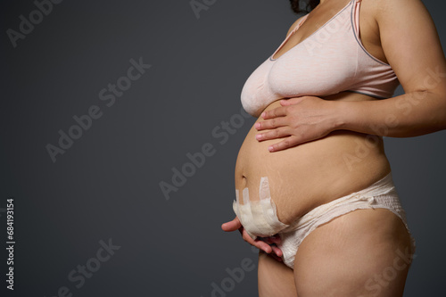 Close-up naked postpartum belly with bandage after cesarean C-section of a body positive woman mother, isolated on gray