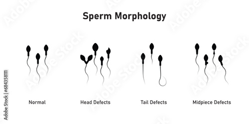 Sperm Morphology Scientific Design. Vector Illustration.