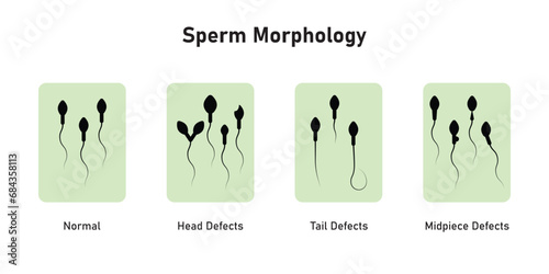 Sperm Morphology Scientific Design. Vector Illustration.