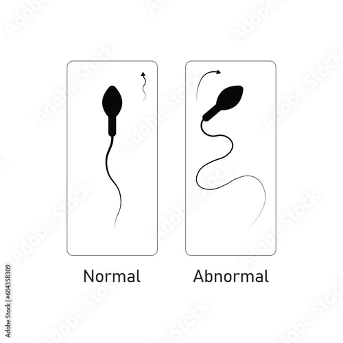 Sperm Motility Scientific Design. Vector Illustration.