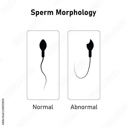 Sperm Morphology Scientific Design. Vector Illustration.