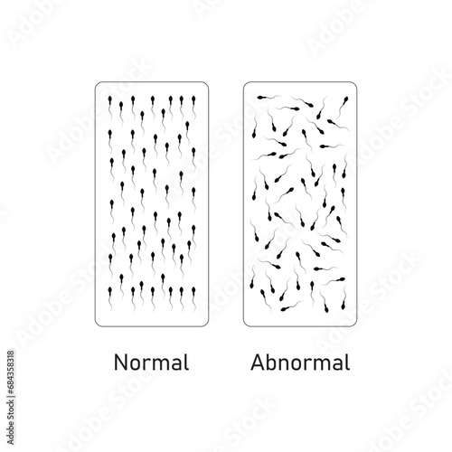 Sperm Motility Scientific Design. Vector Illustration. photo